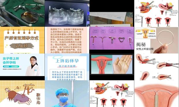 汕头上环会怀孕吗