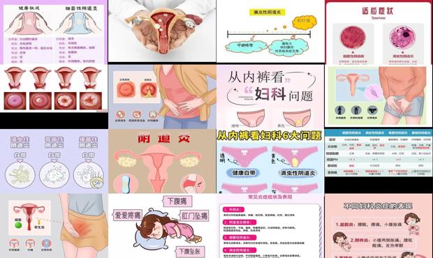 汕头阴到炎症是什么症状