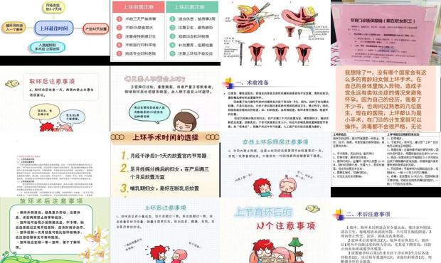 汕头女人上环后要注意什么