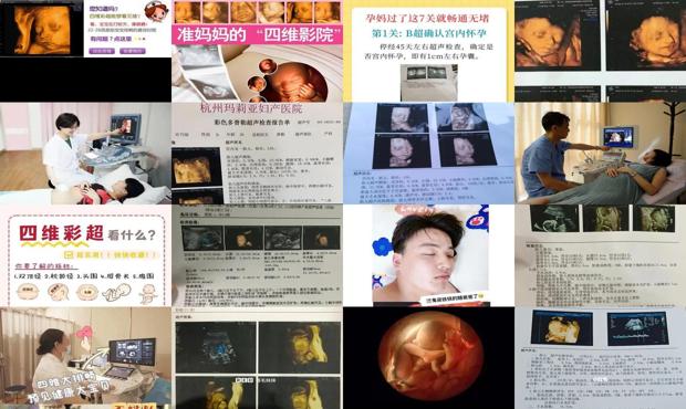 汕头做四维彩超需要空腹吗