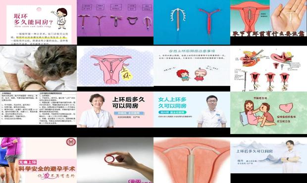 汕头女人带上环几天能同房