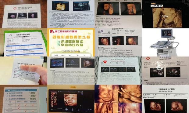 汕头四维彩超一般多少钱