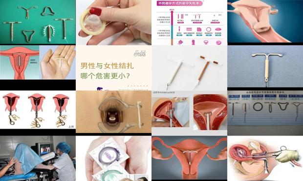 汕头女人上环好还是带套好