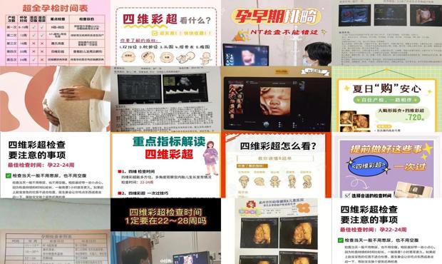 汕头四维*佳检查时间