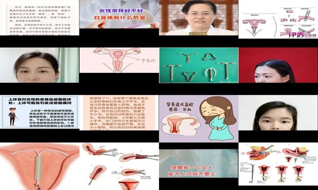 汕头女人上环对身体有什么影响