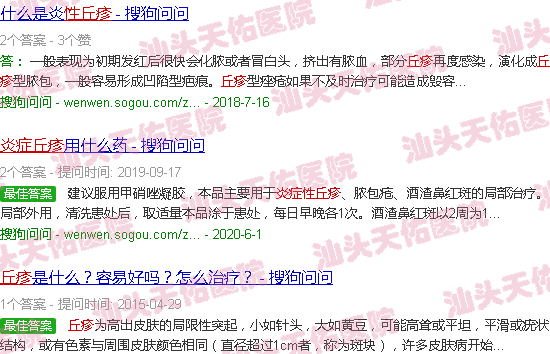 汕头炎症性丘疹