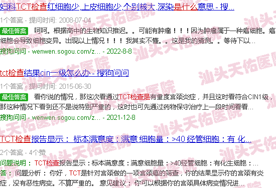 汕头tct检查是什么