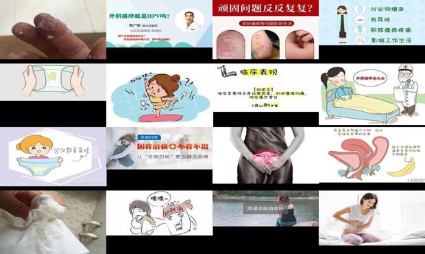 汕头外阴瘙痒会导致不孕吗