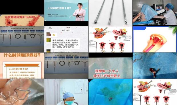 汕头上环和取环哪个痛