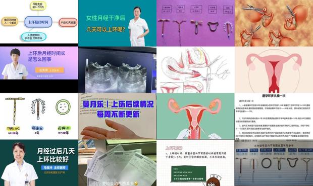 汕头月经过后几天可以上环
