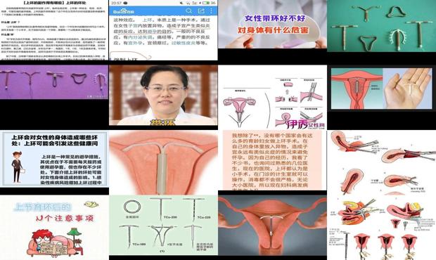 汕头上环对身体的影响