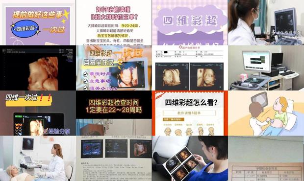 汕头做四维彩超*佳时间