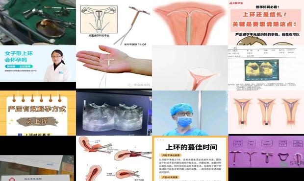 汕头上环怀孕了怎么办