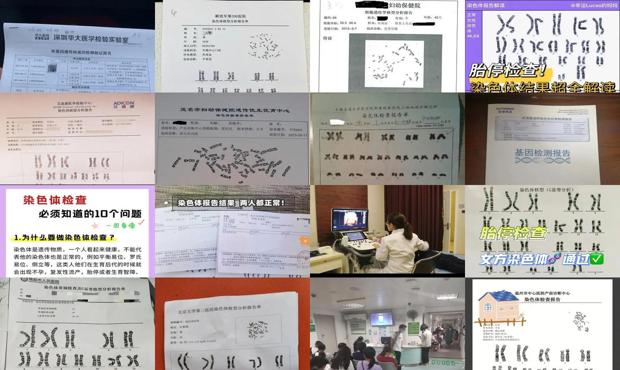 汕头染色体检查