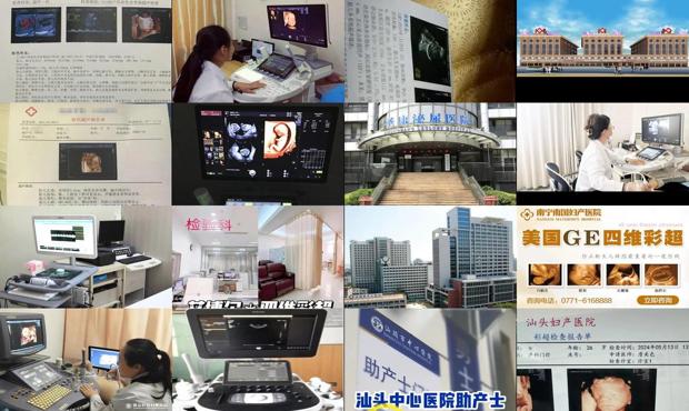 汕头哪个医院做四维好