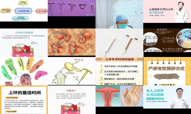 汕头什么时候可以上环