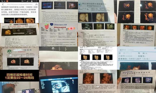 汕头多少周可以做四维