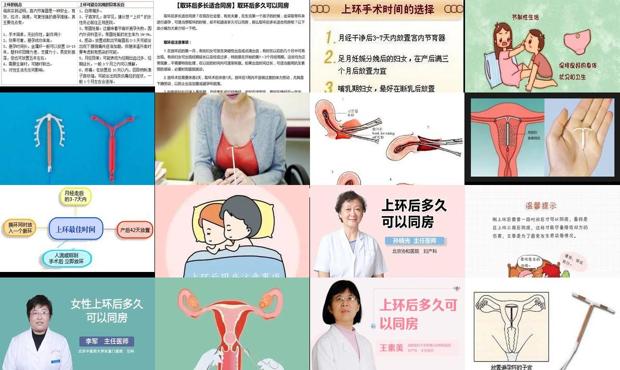 汕头同房后能上环吗
