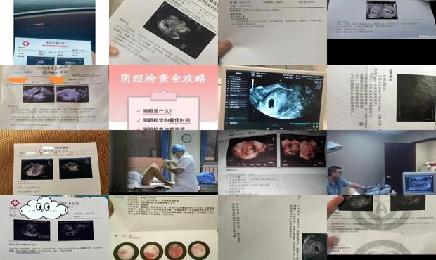 汕头阴超能检查出什么