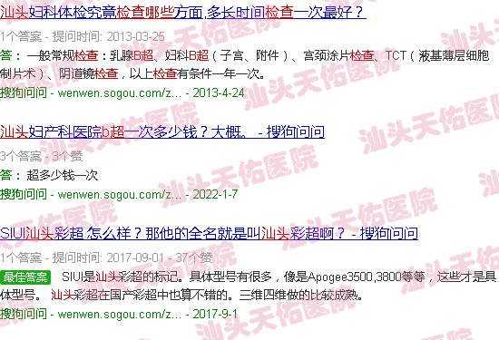 汕头b超可以检查什么