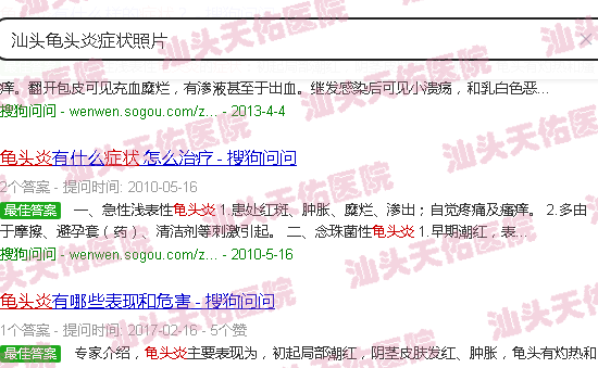 汕头龟头炎症状照片