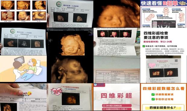 汕头孕妇四维彩超几个月做