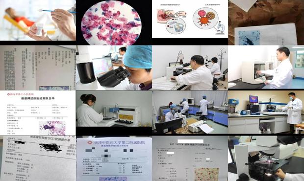 汕头液基细胞学检查