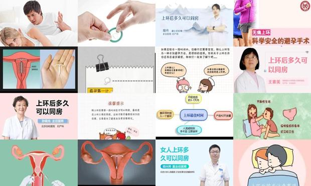 汕头上环几天同房
