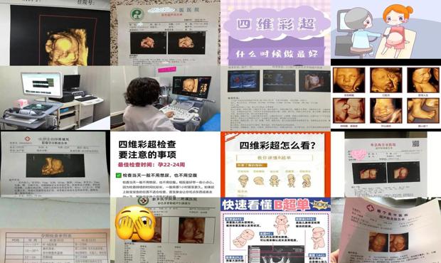汕头怀孕几月做四维