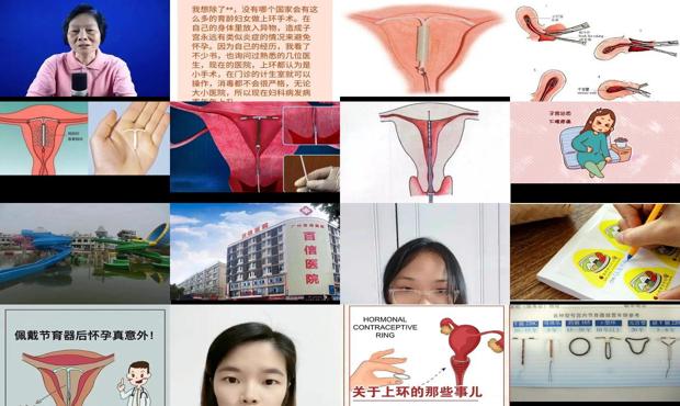 汕头女性上环好不好