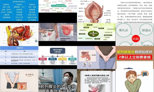 汕头前列腺炎症状有几种
