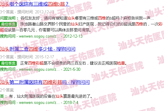 汕头四维彩超检查