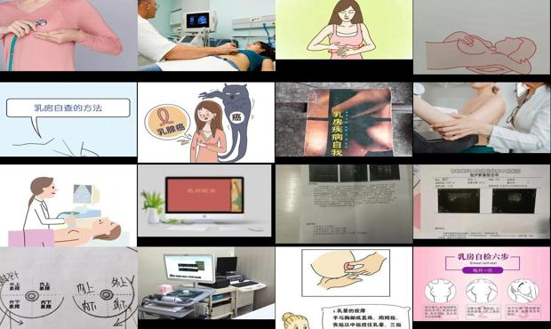 汕头检查乳房需要多少钱