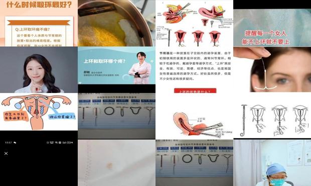 汕头取环疼还是上环疼