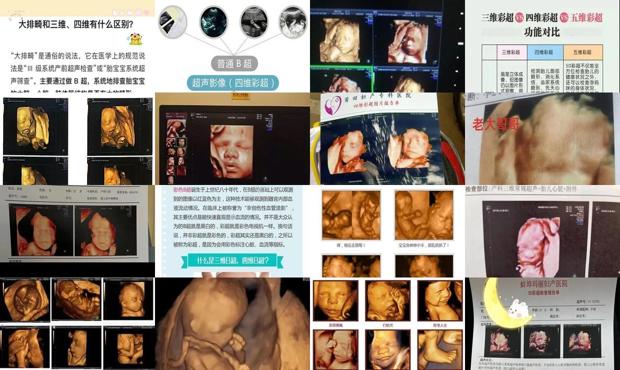 汕头三维和四维有什么区别
