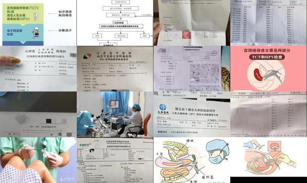 汕头宫颈筛查是检查什么