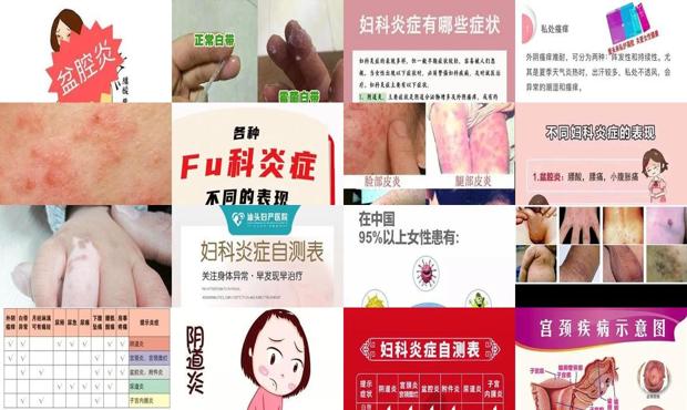 汕头炎症的症状有哪些