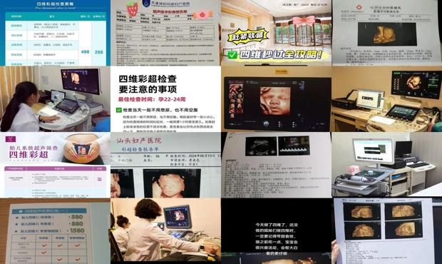 汕头做四维彩超价格