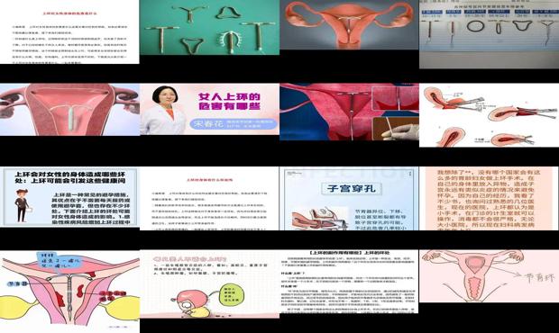 汕头上环的危害