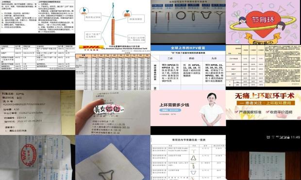 汕头上环需要多少费用