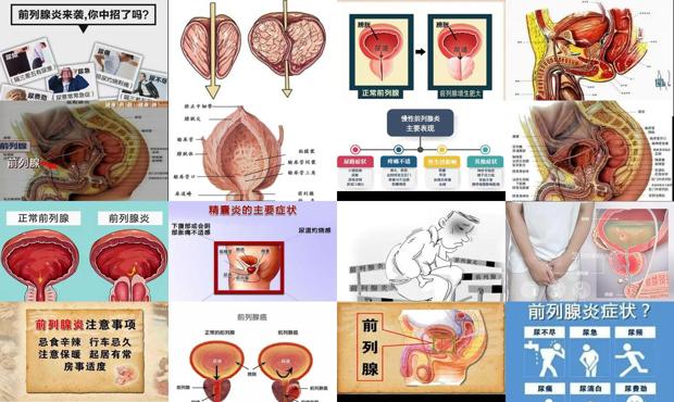 汕头什么是前列腺炎症状