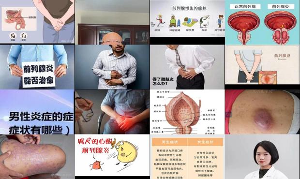 汕头男人有炎症有什么症状