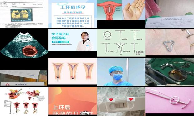 汕头上环怀孕的几*有多高