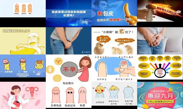 汕头包皮会不会导致不孕