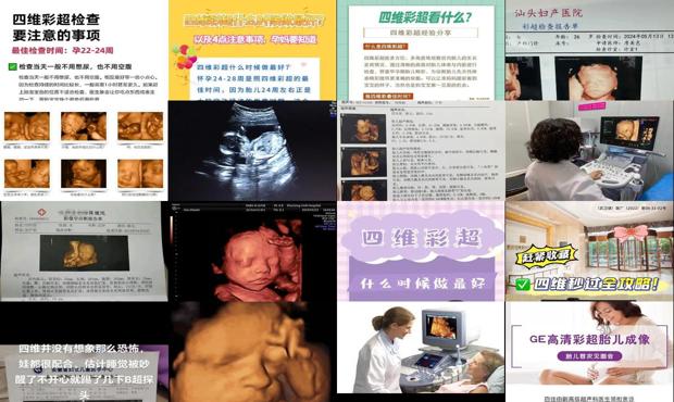 汕头什么时候做四维彩超*好