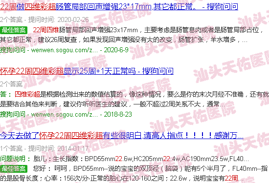 汕头孕22周四维彩超