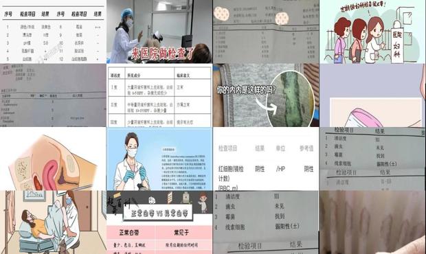 汕头白带异常怎么检查