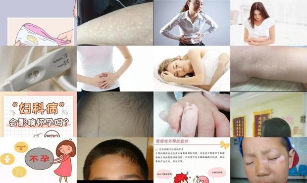 汕头不孕有什么初期症状