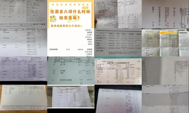汕头六项激素检查