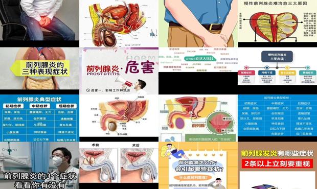 汕头男士前列腺炎症状有哪些